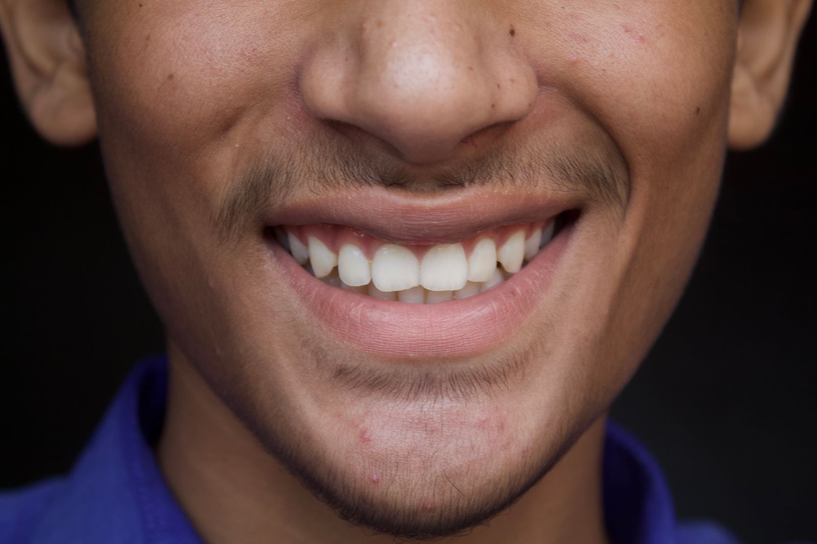 Quais as importâncias dos dentes saudáveis em boca?