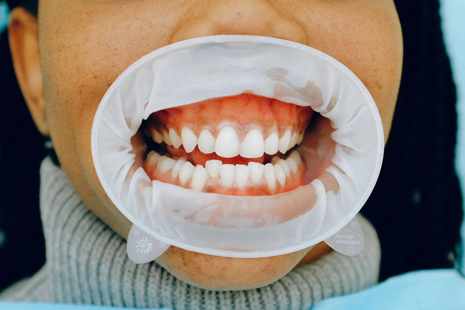 Como que as bactérias da boca podem afetar o coração?