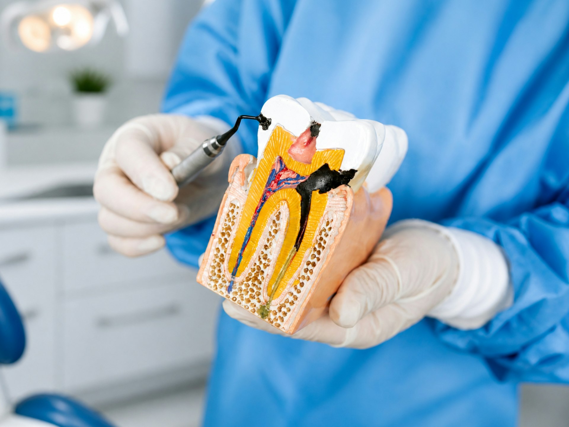 Endodontia - Tratamento de canal
