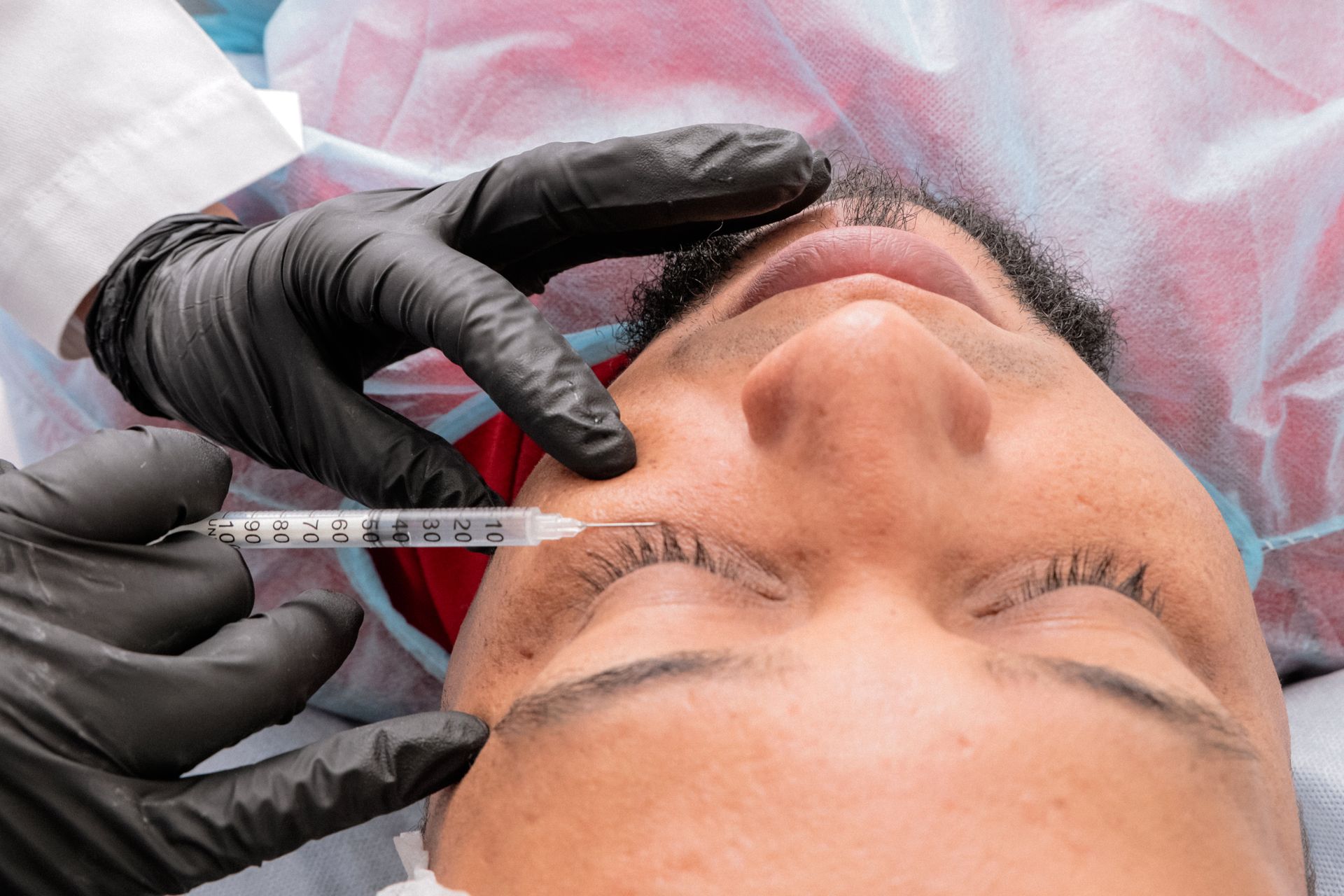 Preenchimento facial