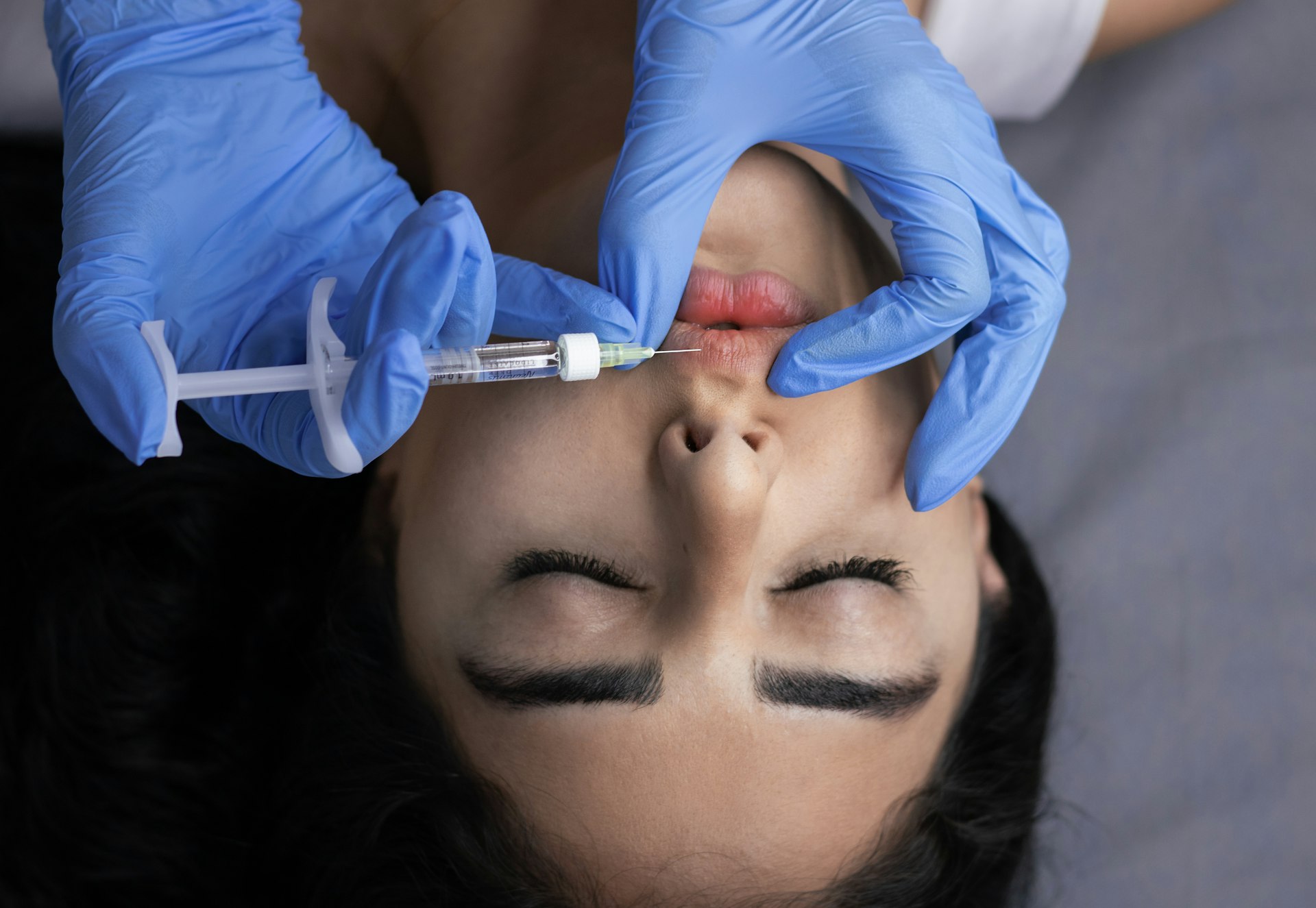 Preenchimento Labial