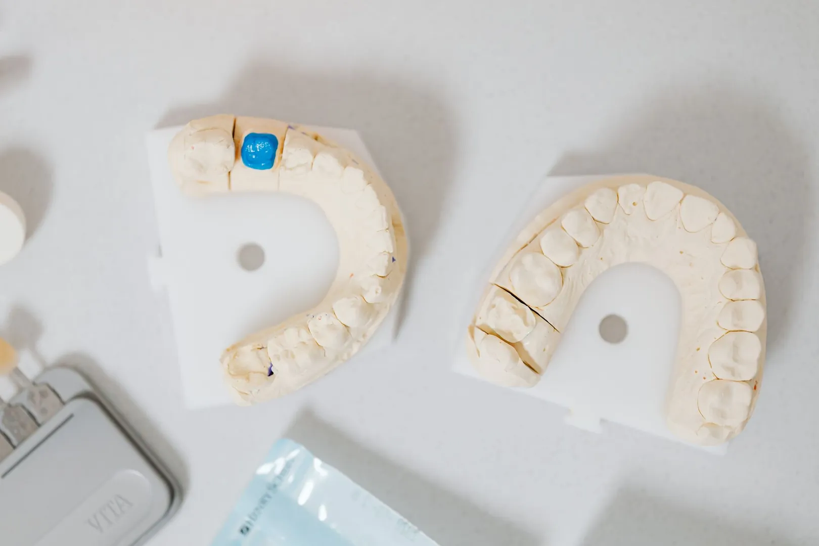 Caracterização Dental em Ouro e Metal